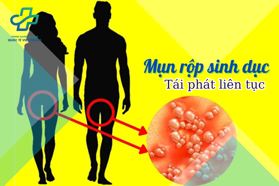 Mụn rộp sinh dục tái phát liên tục vì sao? Điều trị như thế nào?